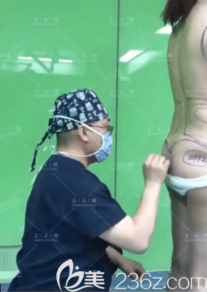 北京上上相侯月华医生给我做腰腹吸脂前设计照