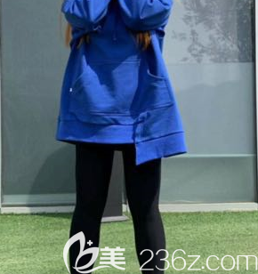 我是免费模特，分享在济南宝琳娜医疗美容诊所面诊大腿吸脂手术的过程