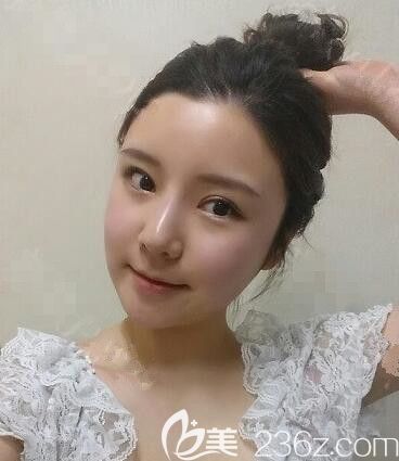 JJ洪镇柱整形梁海元轮廓怎么样 JJ洪镇柱整形梁海元轮廓怎么样