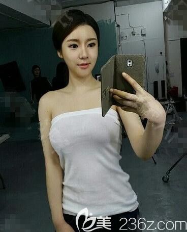 JJ洪镇柱整形怎么样 JJ洪镇柱整形怎么样