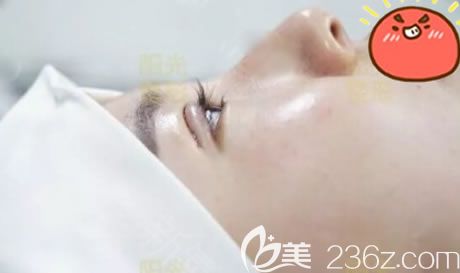 刚做完双眼皮和开眼角的图片