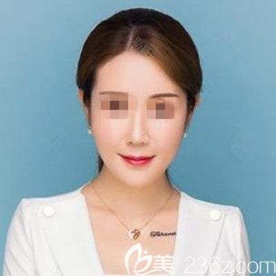 找韩国宝士丽李承浩做面部埋线提升+轮廓针3个月的效果我就很喜欢