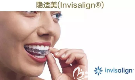 隐适美
