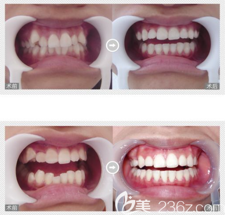 贵州利美康能做牙齿正畸吗
