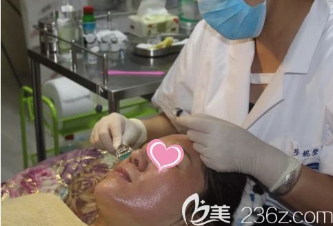 长春珍妮整形的微针治疗过程图