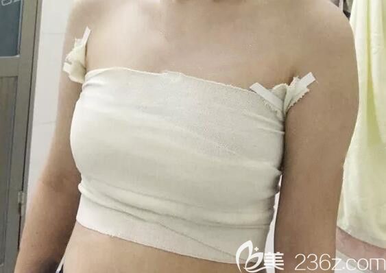 我在南宁美丽星整形做自体脂肪隆胸术后当天照片 我在南宁美丽星整形做自体脂肪隆胸术后当天照片