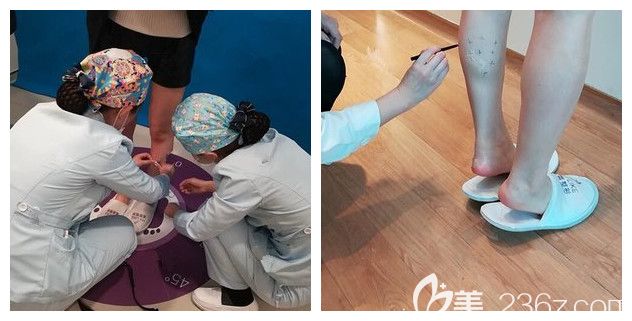 注射前测量腿围标注瘦腿注射位置 注射前测量腿围标注瘦腿注射位置