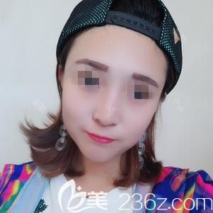 邱荣强医生为我做激光去斑术后12天皮肤洁白无瑕 邱荣强医生为我做激光去斑术后12天皮肤洁白无瑕