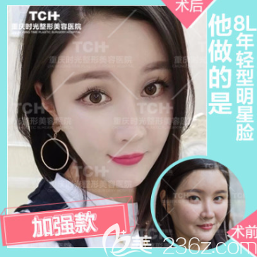 重庆时光整形面部线雕 重庆时光整形面部线雕