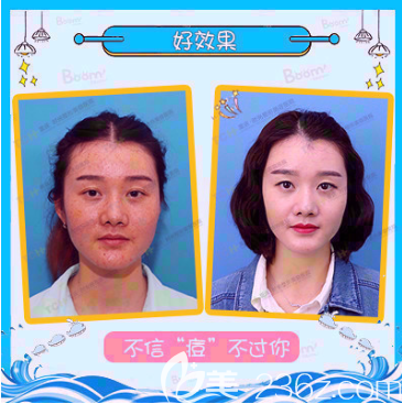 重庆时光整形祛斑祛痘 重庆时光整形祛斑祛痘