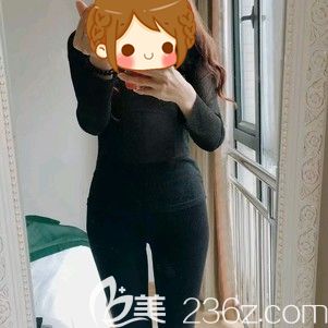做腰腹吸脂术后15天抽脂部位还是有点小疼 做腰腹吸脂术后15天抽脂部位还是有点小疼