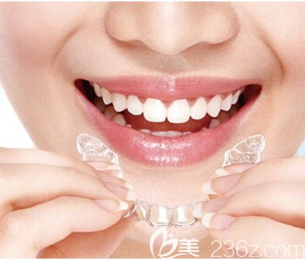 洛阳九龙口腔刘春丽介绍时代天使隐形双模和单模的区别 洛阳九龙口腔刘春丽介绍时代天使隐形双模和单模的区别