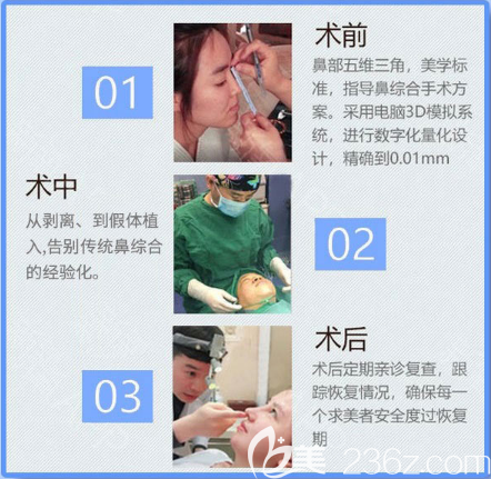 汕头华美隆鼻手术过程图 汕头华美隆鼻手术过程图