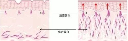 韩国清谭优面部提升原理 韩国清谭优面部提升原理