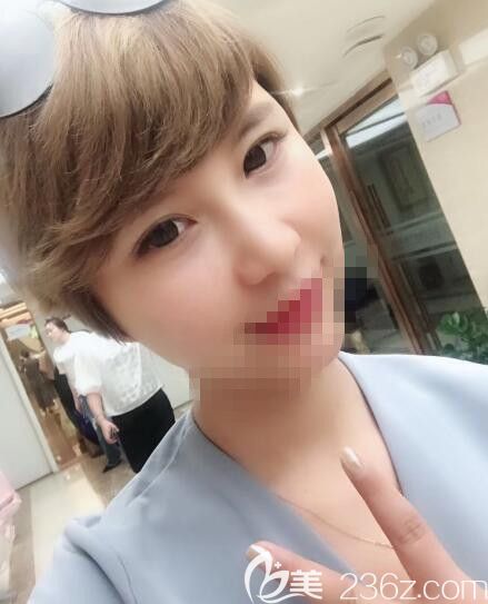 术后一个月,感觉自己越来越上镜 术后一个月,感觉自己越来越上镜