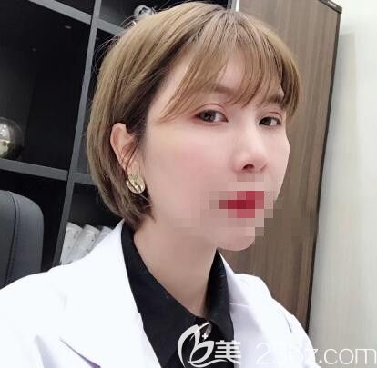 郑州艺龄员工亲自体验李冰院长的自体脂肪填充手术 年轻美丽妥妥的