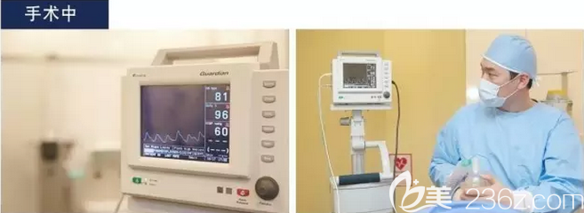 韩国欧米茄整形术中安全监测 韩国欧米茄整形术中安全监测