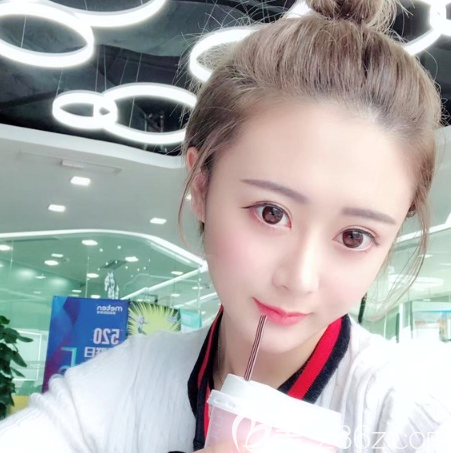 广州中家医家庭医生朱云做脂肪填充<span style=