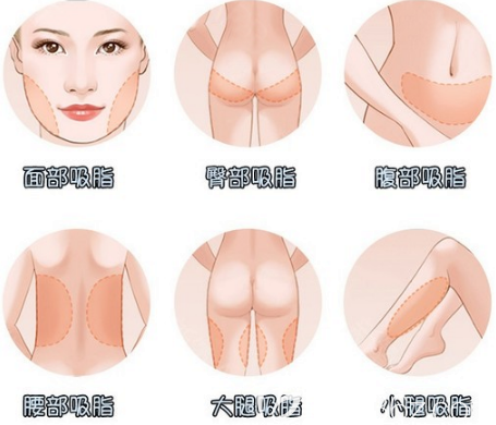 中信惠州医院整形科吸脂项目