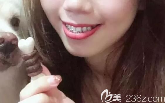 在<!--<i data=20240703-sp></i>-->雅悦口腔做矫正中 在<!--<i data=20240703-sp></i>-->雅悦口腔做矫正中