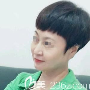 赵彦光医生为我做埋线提升术后10天面部皮肤紧致