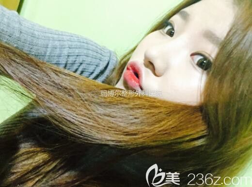 130斤的既视感在韩国玛博尔整形范做了鼻子和溶脂提升感觉减了20斤