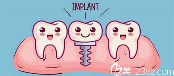 关于种植牙的一些小常识