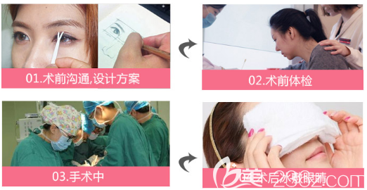 中信惠州医院整形科双眼皮手术过程图