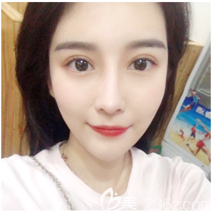 中信惠州医院整形美容科做双眼皮怎么样