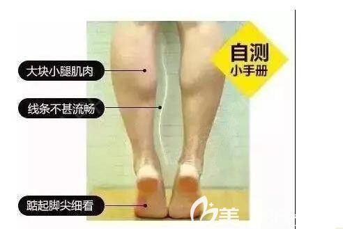 小腿粗壮的肌肉型人士