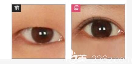 华美官网展示的真人案例图片