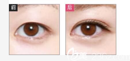 华美真人案例图片