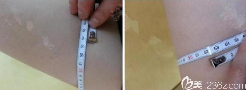 腿围前后变化 腿围前后变化