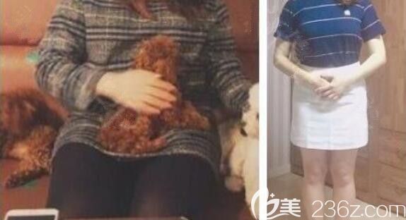 韩国美尔韩整形外科医院减肥真人<span style= 韩国美尔韩整形外科医院减肥真人<span style=