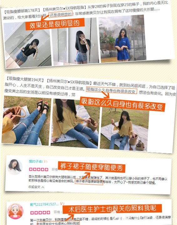 对扬州美贝尔SX导航吸脂评价 对扬州美贝尔SX导航吸脂评价