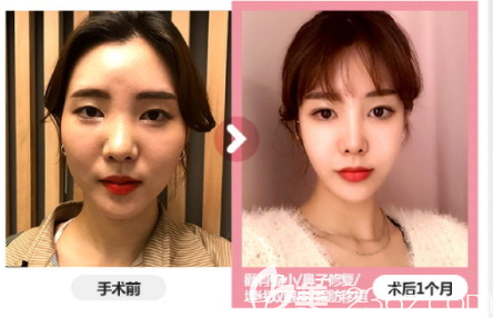 20190614_1560483134179912.png image.png