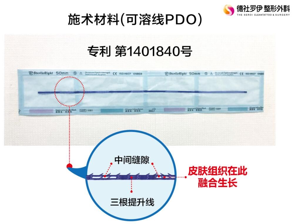 普罗菲耳线雕可溶线PDO核心技术