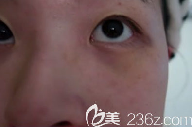 潍坊华美创和做激光祛斑蛮不错的，而且收费价格也不贵哦