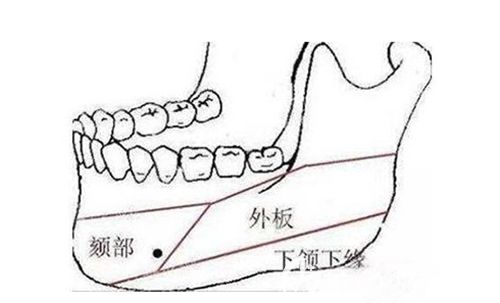 韩国面部轮廓四件套手术 韩国面部轮廓四件套手术