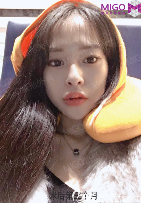 韩国migo姜垠宅做鼻子怎么样