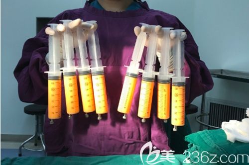 从身体内吸出来的脂肪图