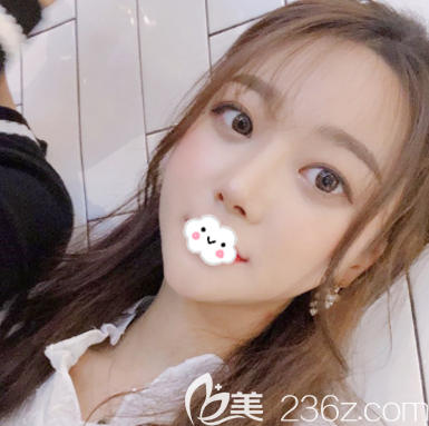 东莞西妃刘波鼻子做的怎么样 东莞西妃刘波鼻子做的怎么样