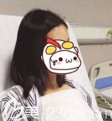 李春雷医生为我刚做完假体隆胸手术胸部肿胀