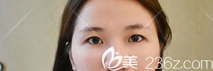 到<!--<i data=20240703-sp></i>-->医院做双眼皮前 到<!--<i data=20240703-sp></i>-->医院做双眼皮前