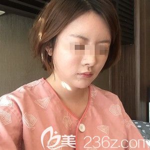 在韩国ARTLINE做面部吸术前 在韩国ARTLINE做面部吸术前