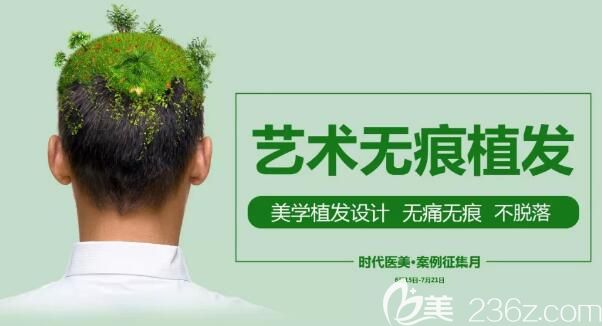 常熟时代艺术无痕植发案例征集月活动