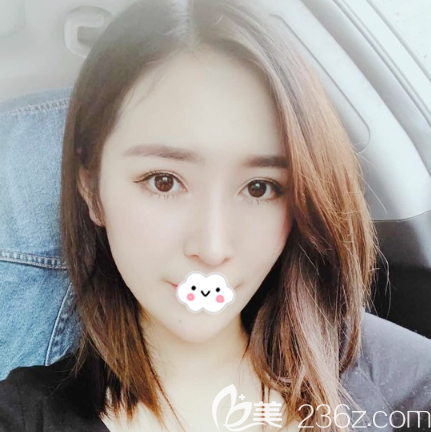 我来告诉你广州紫馨李石峰做鼻子怎么样 我来告诉你广州紫馨李石峰做鼻子怎么样