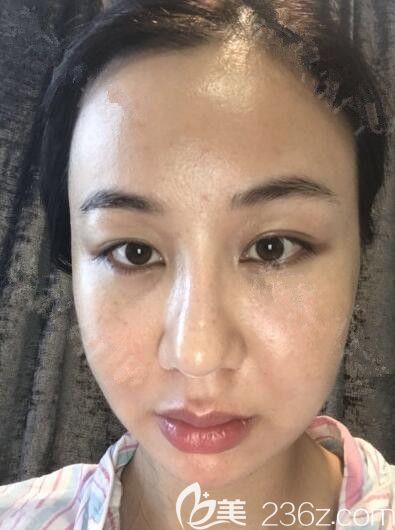 20190620_1561018610589582.jpg 2周_副本.jpg