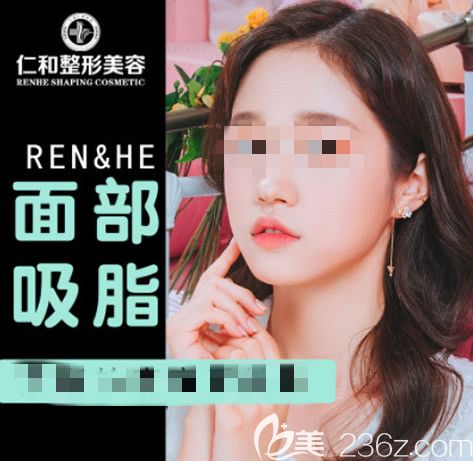 兰州仁和刘显超面部吸脂三个月效果图片 兰州仁和刘显超面部吸脂三个月效果图片