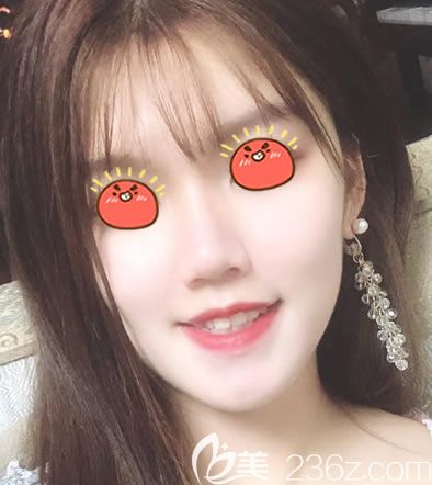 杭州薇琳面部提升术<span style= 杭州薇琳面部提升术<span style=